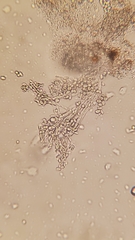 Penicillium digitatum