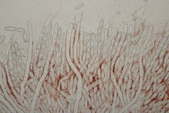 Sarcoscypha coccinea