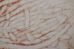 Sarcoscypha coccinea