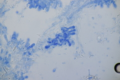 Xenasmatella vaga