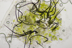 Colletotrichum trichellum