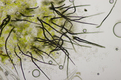 Colletotrichum trichellum