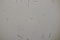 Colletotrichum trichellum