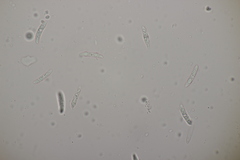 Colletotrichum trichellum