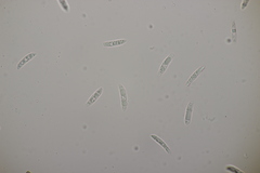 Colletotrichum trichellum