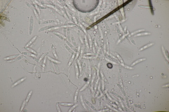 Colletotrichum trichellum
