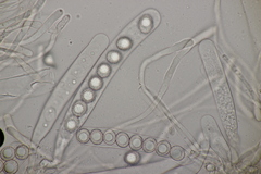 Octospora affinis