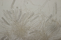 Octospora affinis