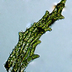 Ephemerum spinulosum