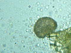 Ephemerum spinulosum