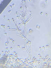 Hypomyces tubariicola