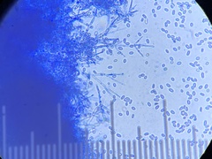 Hypomyces tubariicola