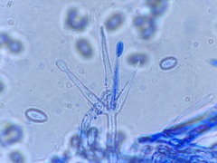 Hypomyces tubariicola