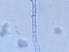 Hypomyces tubariicola