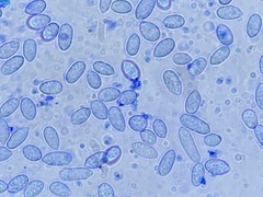 Hypomyces tubariicola