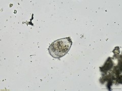 Euglypha strigosa