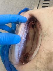 Carcharhinus altimus