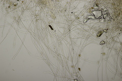 Sarcoscypha coccinea