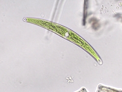 Closterium tumidum