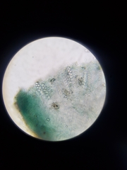 Mniaecia jungermanniae