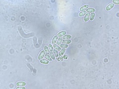 Volutella ciliata
