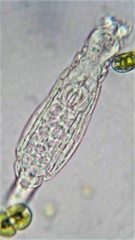 Habrotrocha constricta