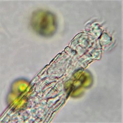 Habrotrocha constricta