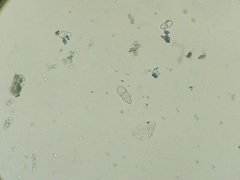 Trichothecium roseum