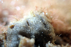 Vulsella