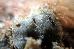 Vulsella