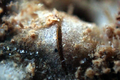 Vulsella