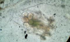 Hexarthra mira