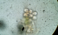 Hexarthra mira