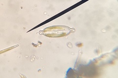 Caloneis amphisbaena