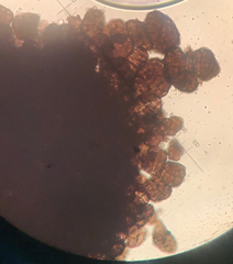 Berkleasmium conglobatum