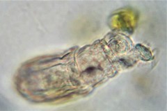 Philodina acuticornis odiosa