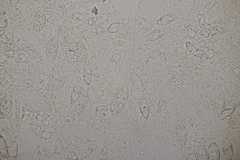 Paranectria oropensis