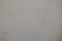 Paranectria oropensis