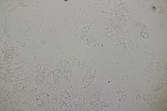 Paranectria oropensis