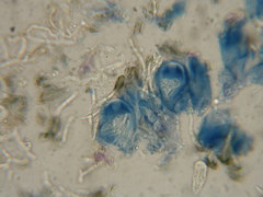Scoliciosporum