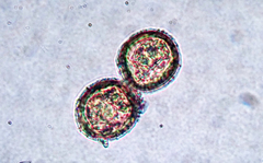 Puccinia embergeriae