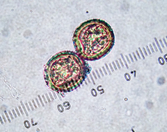 Puccinia embergeriae