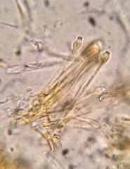 Orbilia xanthoguttulata