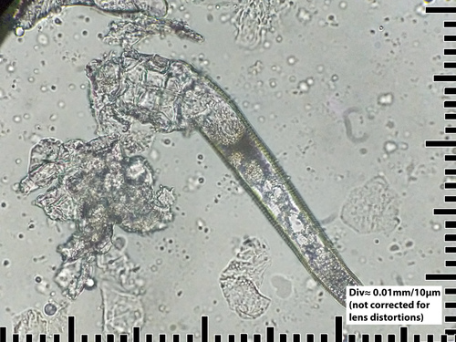 Human Follicle Mite