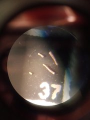 Scherochorella moniliformis