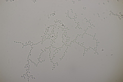 Fibulomyces mutabilis