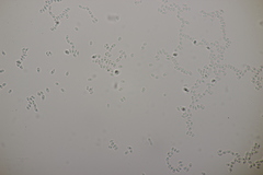 Fibulomyces mutabilis