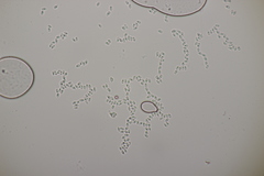 Fibulomyces mutabilis