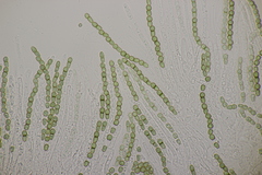 Trichoderma gelatinosum