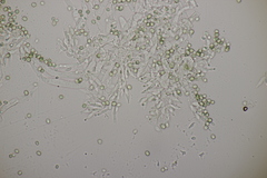 Trichoderma gelatinosum